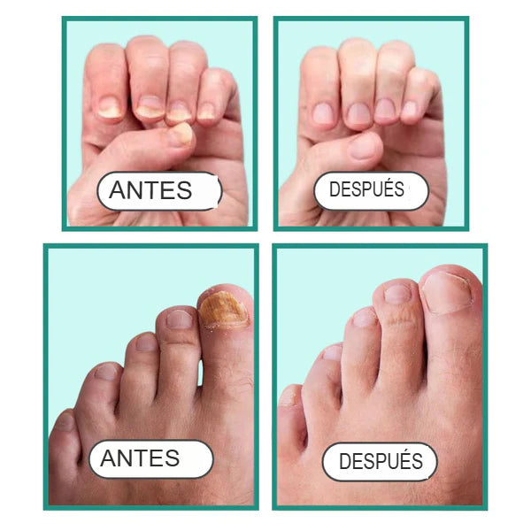 (cópia) Antifúngico clínico Diorah