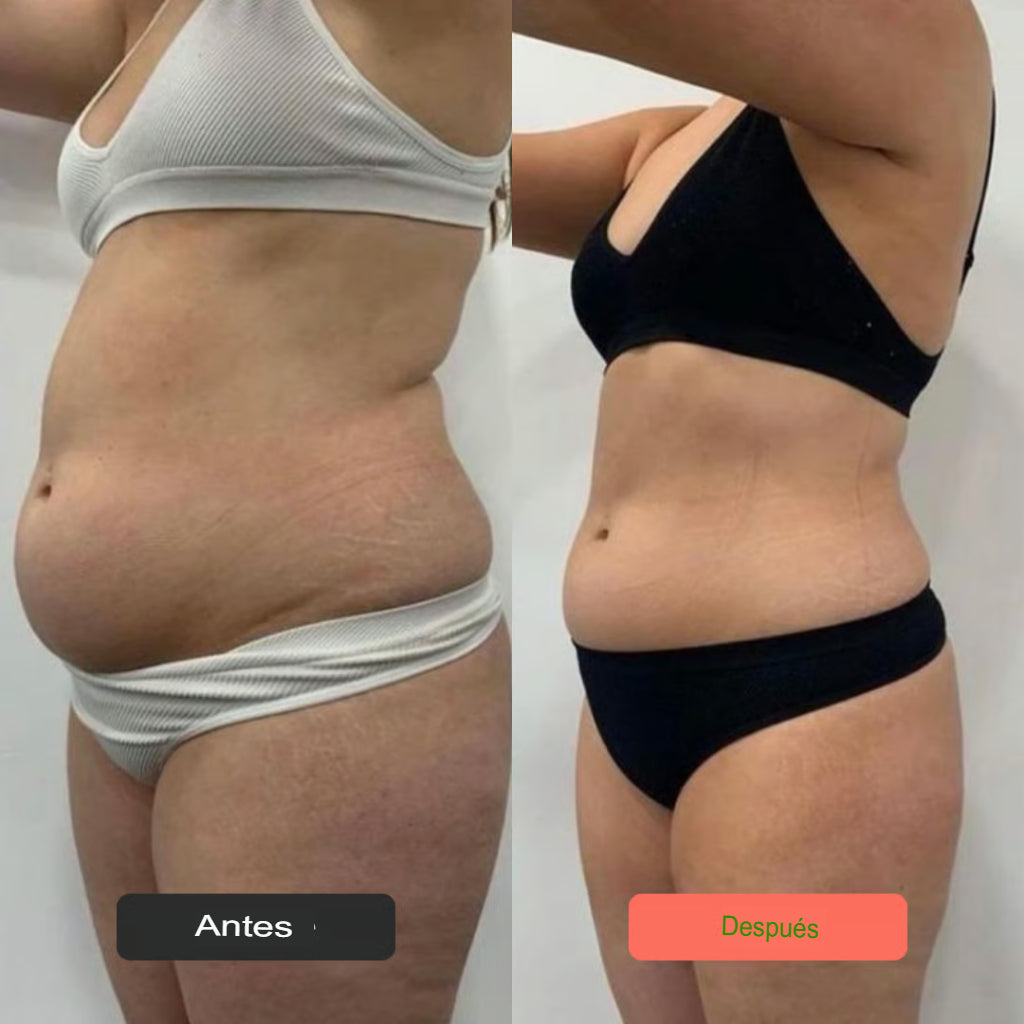 Diorah Cellulite Eliminator No. 1