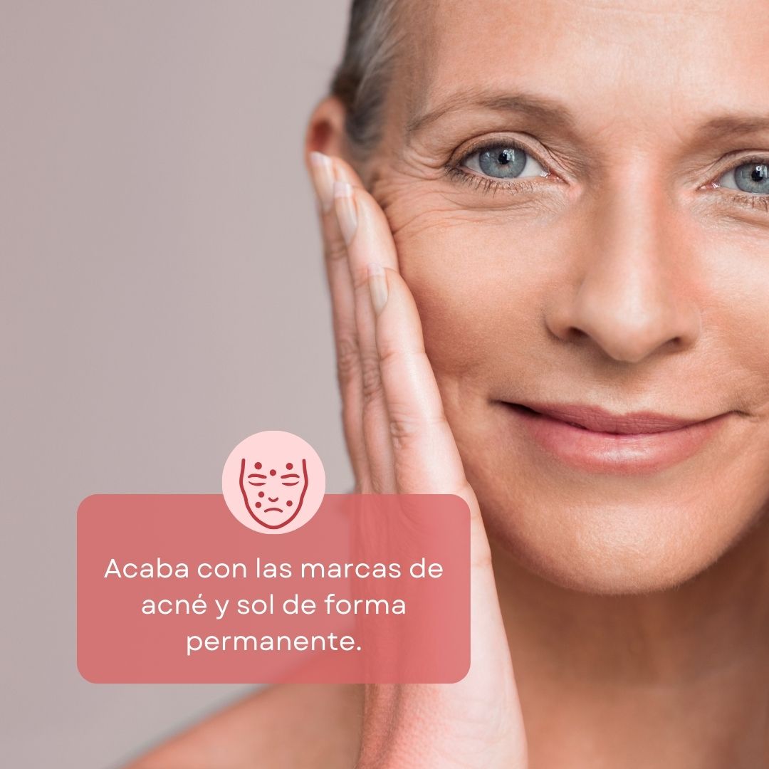 Sérum Corrector con Niacinamida y Ácido Tranexámico Antiacné