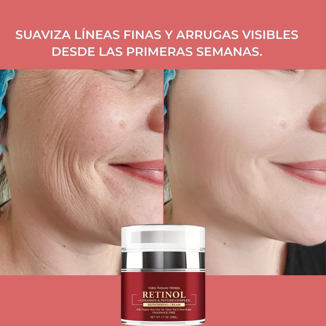 Crema con Retinol Antiarrugas y Reafirmante Hidratante