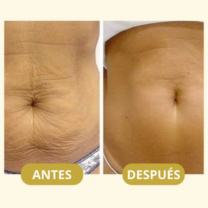 Aceite Mágico de Belleza™  Elixir Rejuvenecedor para Tu Piel